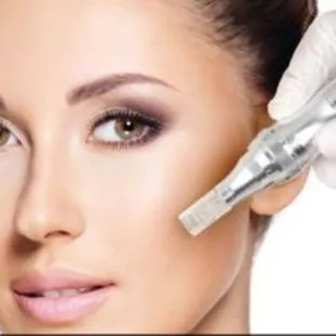 Microneedling