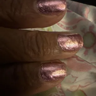 Correction of initial pedi-cure