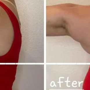 Side view of my left arm!