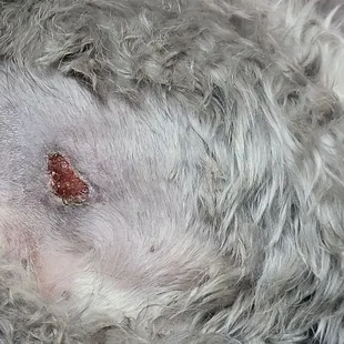 10 days later antibiotics,irrigated let it close up cbd no surgery, No infection No anesthesia.