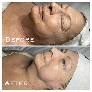 DMK Stemzyme and enzyme is your holistic firming facial.