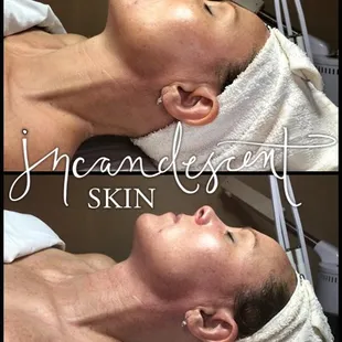 DMK Level 1 facial in Tucson @ Incandescent Skin. Natural, Healing &amp; Holistic Anti-Aging Treatments. Local Lashes, Brows, Local Sugaring