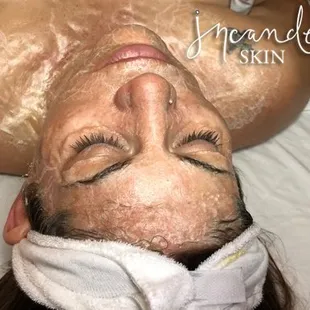 Facials, Anti-Aging, Top Skin Care in Tucson. DMK Enzyme treatment. The Zombie Facial only at Incandescent Skin.