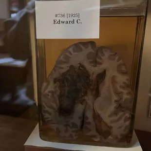 Preserved hemorrhaged brain