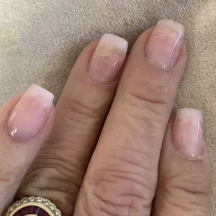 Ruined nailbeds and French Manicure??