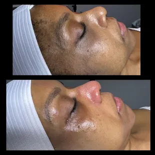 Before and After shots