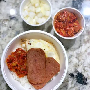 Rice Bowls