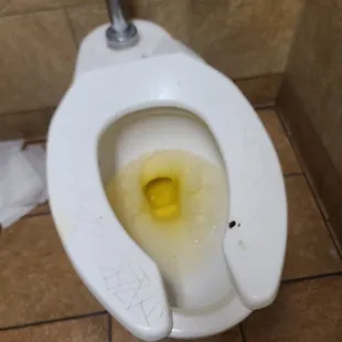 Dirty ass toilet