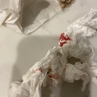 My injuries