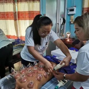 Cupping Therapy