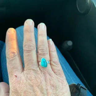 My amazing ring