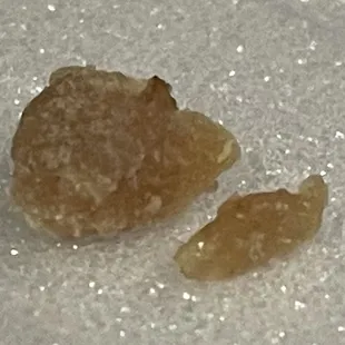 Bone pieces in burger