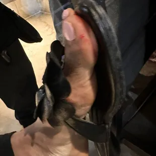 There was a dirty fork on the floor and stab my friends foot