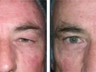 Fresno Plastic Surgery