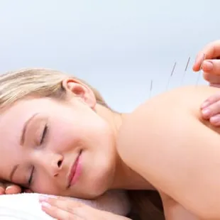 Acupuncture in private rooms
