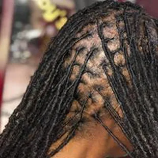 Dread Extensions and Retwist