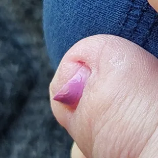 OMG how crooked and not entirely polished.