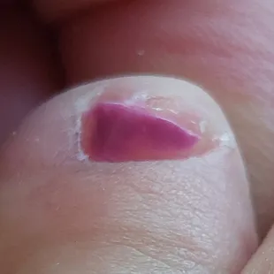 Nail is crooked and not entirely polished.
