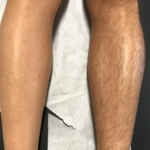 Leg Wax