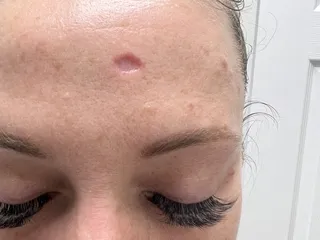 Leslie Storey, MD - Valley Skin Institute
