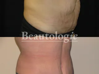 Beautologie Cosmetic Surgery & Medspa Fresno