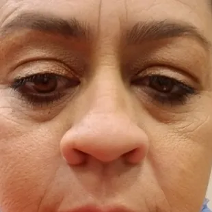 This is a week after I had it done. No filter (obviously lol)