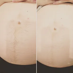 Mom-to-be Tummy trail