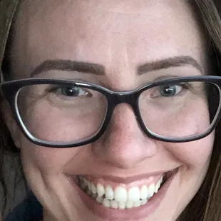 Healed brow, no makeup, Kendra's correction