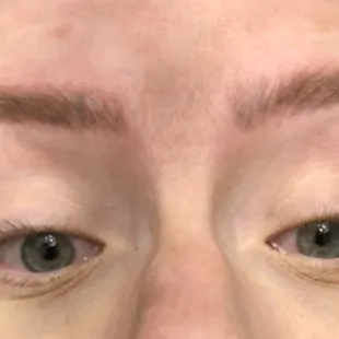 Before photo with uneven yucky brows from microblading and microblading lightening treatment elsewhere.