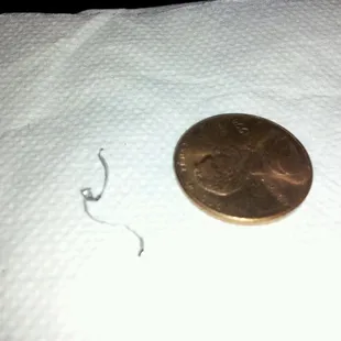 Well the one to ur left is what I found on my shrimp and broccoli it seems to be a wire from a steel brush