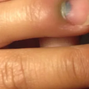 My son's fingernail after leaving kids quest