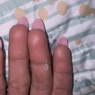 the underneath of them.