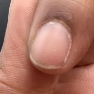 My "manicured" index finger