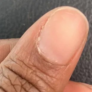 My "manicured" thumb