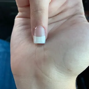 Hurt cuticle on myself