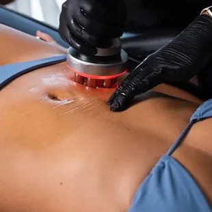 Body sculpting at Kiss Me