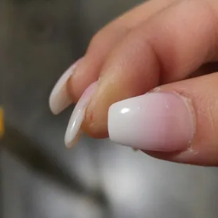 Deep cut hurts so bad!! All Side of nails are not filed correctly