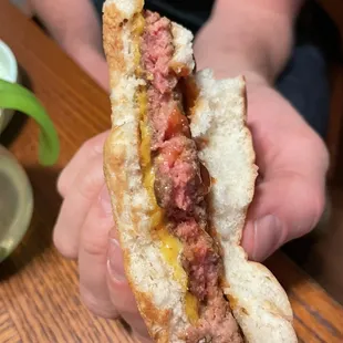 Undercooked burger