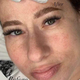 When you look and feel 5 years younger