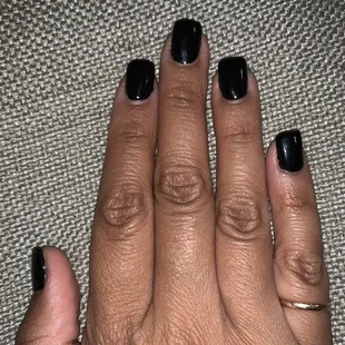 My middle finger nail is not straight