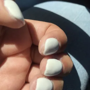 Nail job gone bad