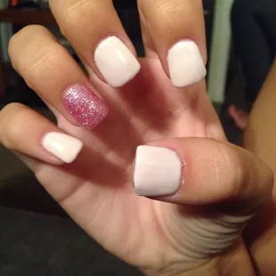 Crooked nails and bumpy thick polish. Supposed to be duck feet.