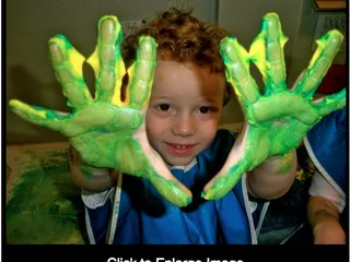 Dermer's Creative Care