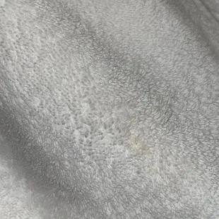 Yellow stains on towel