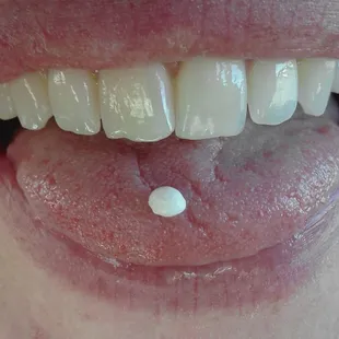 I found a pearl in my fried oyster!!!