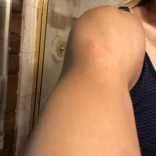 More bites
