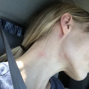 Even my neck
