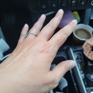 My hand soaked in hot coffee