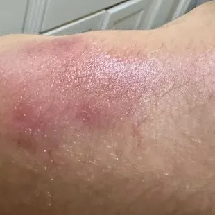 Child ended up with bad bruises on both shoulders from how heavy the vests were.