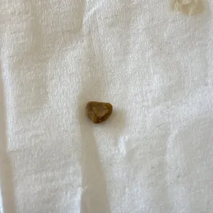 That is the rock found in my fried rice!